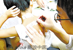 灸法的種類  你知道多少？